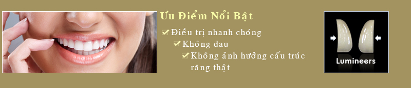 Bọc răng sứ Lumineers thẩm mỹ