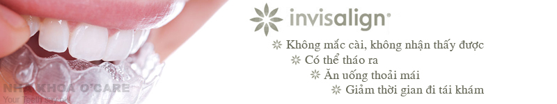 Chỉnh nha Invisalign, không mắc cài